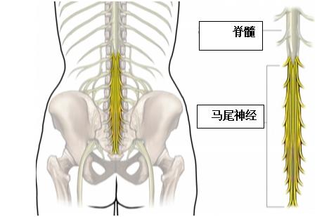 肛門會(huì)陰有異樣感=馬尾神經(jīng)受壓？