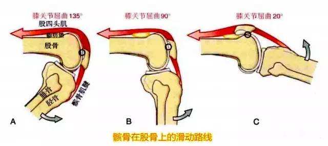 爬樓梯膝蓋就疼，這究竟是怎么回事？