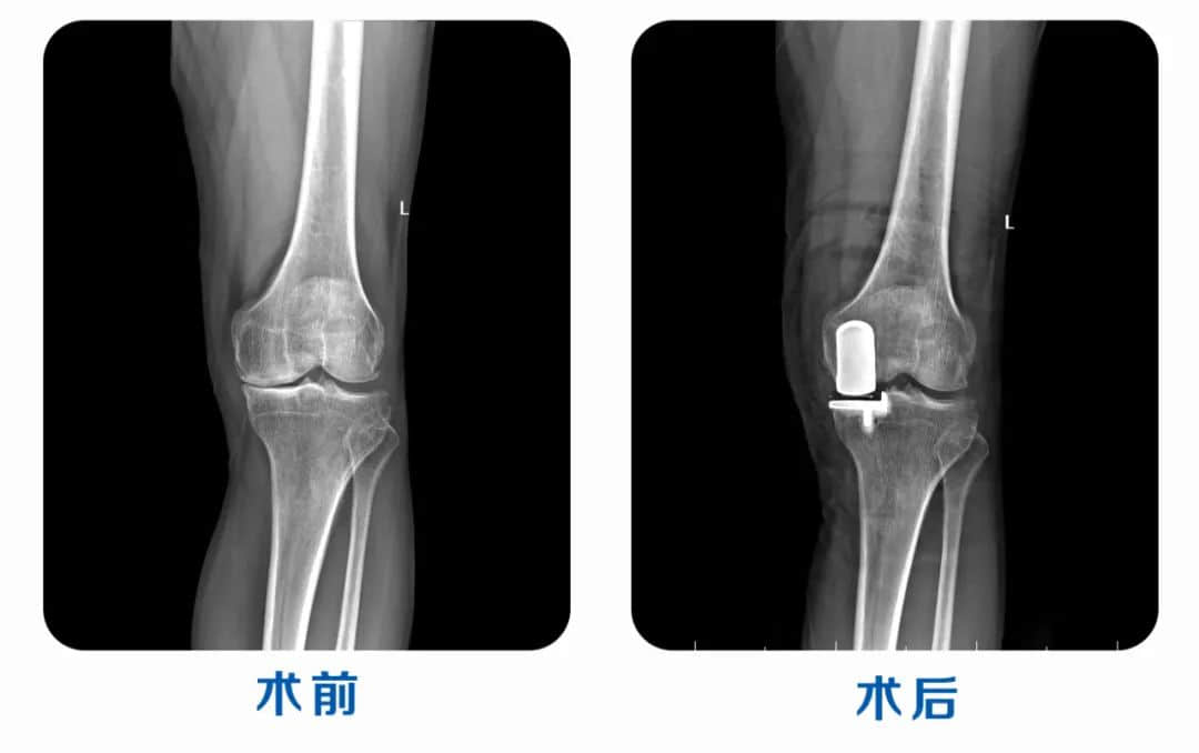 蓮池榮耀|熱烈祝賀我院業(yè)務院長呂巖榮獲全國單髁手術技術大賽三等獎