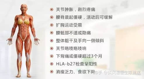 患上了強(qiáng)直性脊柱炎，小心膝關(guān)節(jié)出現(xiàn)關(guān)節(jié)炎。