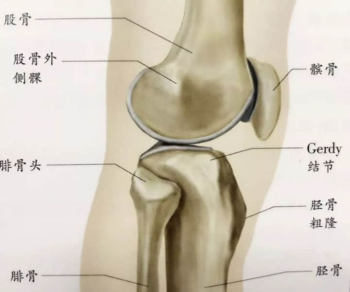 髕骨周圍痛，膝“打軟”，說說髕股疼痛綜合征