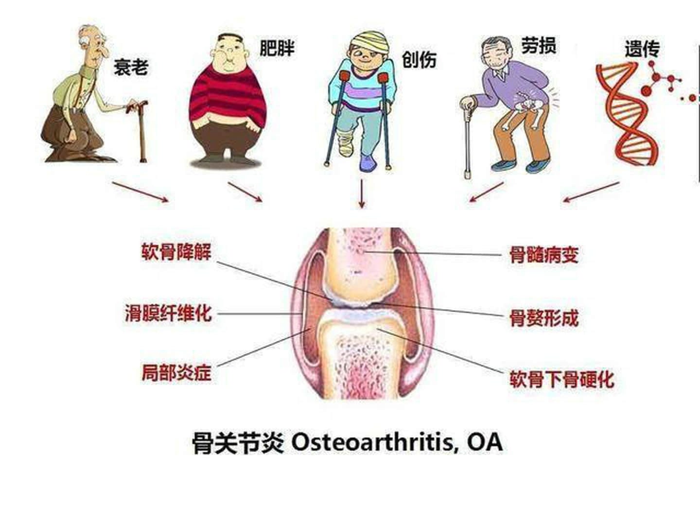 退行性骨關節(jié)炎怎么治